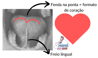 Língua presa mostrando ponta em formato de coração.